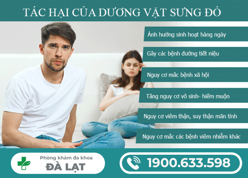 Hình ảnh minh họa